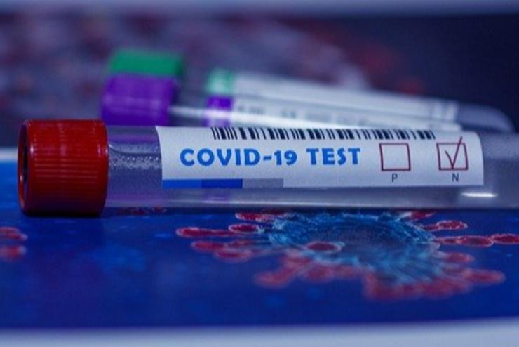 Koronavírus-járvány: megduplázza a tesztelési kapacitást Ausztria a hétfői nyitás és az ingázók miatt