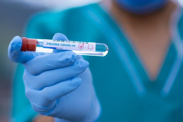 Tisztiforvos: szombattl a Magyarorszgra rkez fizeti a PCR-tesztet