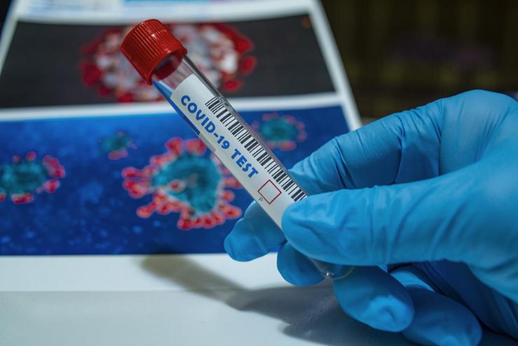 Országos tisztifőorvos: fertőzésgyanú esetén mindenkinél térítésmentesen elvégzik a PCR-tesztet